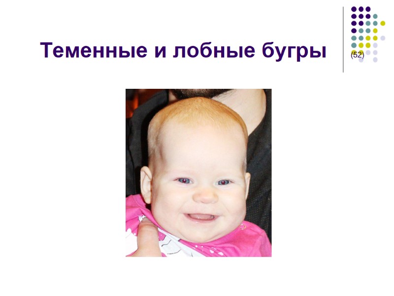 Теменные и лобные бугры    (52)